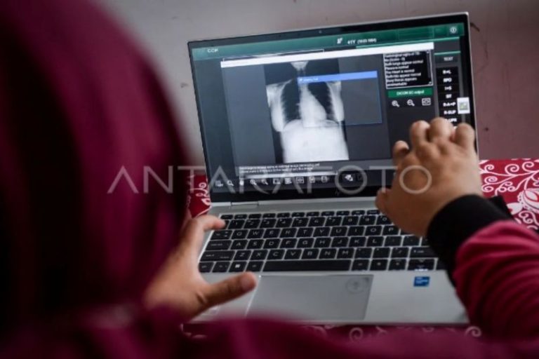 RI tambah anggaran khusus untuk percepatan deteksi TBC pada 2026