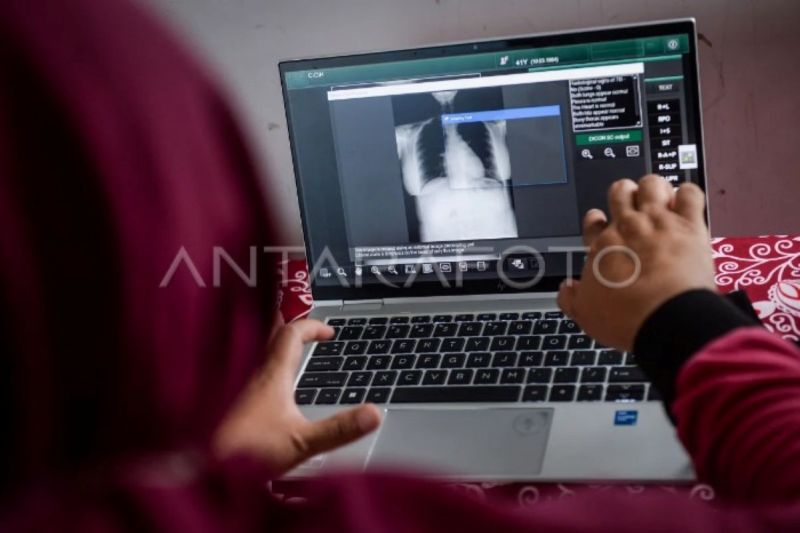 RI tambah anggaran khusus untuk percepatan deteksi TBC pada 2026